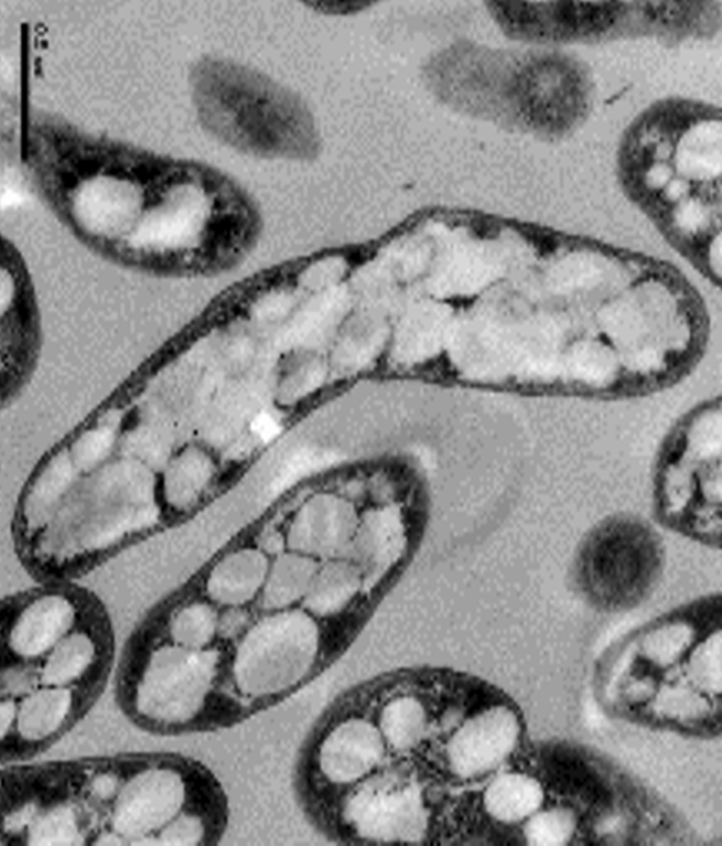 Bacterium with PHA Granules